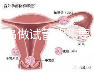 去青島做試管嬰兒要多少錢(qián)？