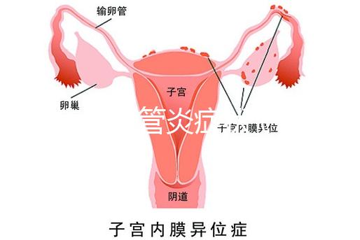 反流性食管炎癥狀（反流性食管炎癥狀有哪些反應(yīng)）
