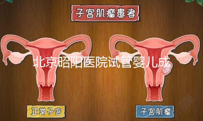 北京昭陽醫院試管嬰兒成功率?生殖醫院醫生排名推薦