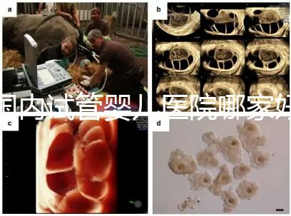 國內(nèi)試管嬰兒醫(yī)院哪家好？慈銘博鰲深受患者信賴