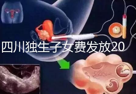 四川獨生子女費發(fā)放2024年新規(guī)定，如何盡快領(lǐng)取自貢？