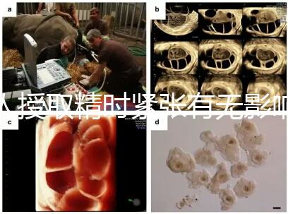 人授取精時緊張有無影響別還不造，注意事項不少不可不知