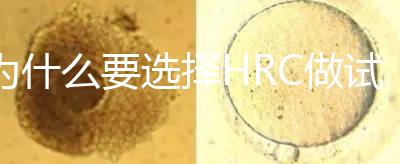 為什么要選擇HRC做試管？這6大優(yōu)勢(shì)看完就知道答案