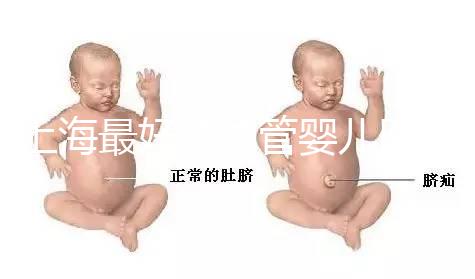 上海最好的試管嬰兒醫(yī)院信息匯總，想要最權(quán)威真得看這幾家