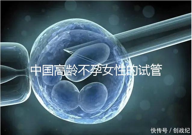中國(guó)高齡不孕女性的試管嬰兒指南，8個(gè)方面5條推薦意見