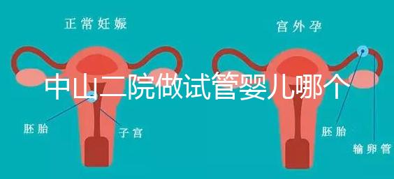 中山二院做試管嬰兒哪個醫(yī)生好？附醫(yī)院試管成功率