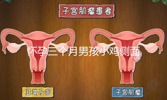 懷孕三個(gè)月男孩小雞側(cè)面二維b超圖片分享，原來(lái)兩腿間有尖