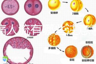 無(wú)痛人流有哪些注意事項(xiàng)?