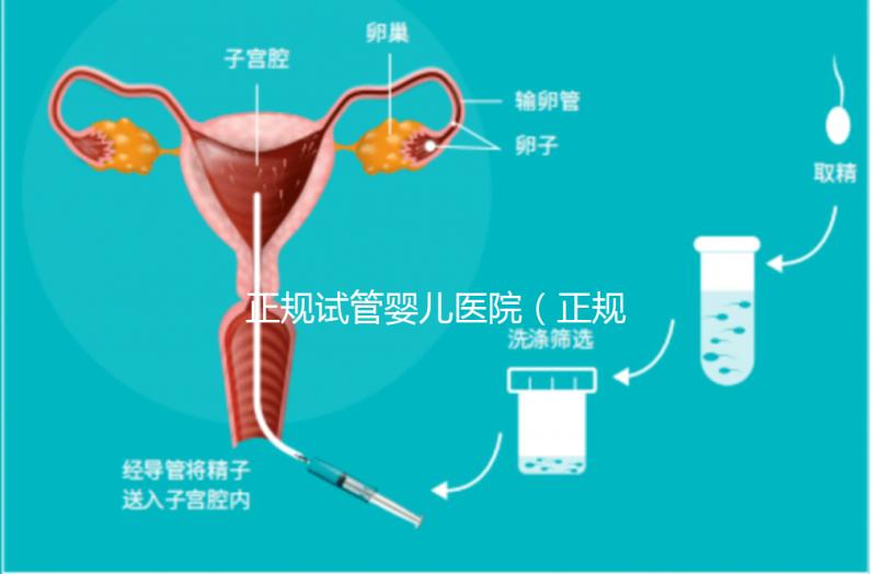 正規(guī)試管嬰兒醫(yī)院（正規(guī)試管嬰兒醫(yī)院排名）