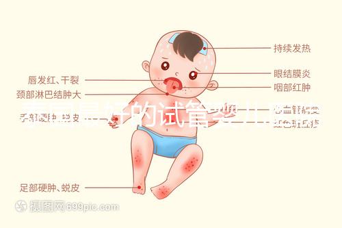 泰國最好的試管嬰兒醫(yī)院（泰國最好的試管嬰兒醫(yī)院是哪個）