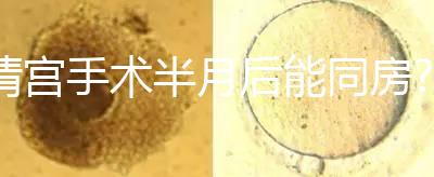 清宮手術半月后能同房?別盲目相信,聽醫生咋說!