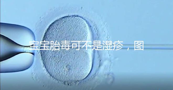 寶寶胎毒可不是濕疹，圖文解讀兩者詳細區(qū)別