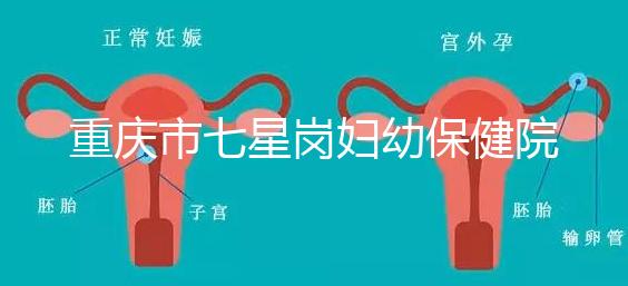 重慶市七星崗婦幼保健院做試管需要多少錢？可以用醫(yī)療保險(xiǎn)嗎？