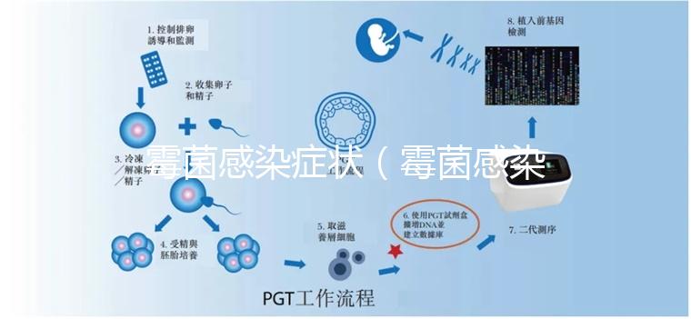 霉菌感染癥狀(霉菌感染癥狀有哪些)