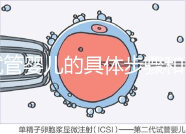 試管嬰兒的具體步驟和（做試管的流程順序）