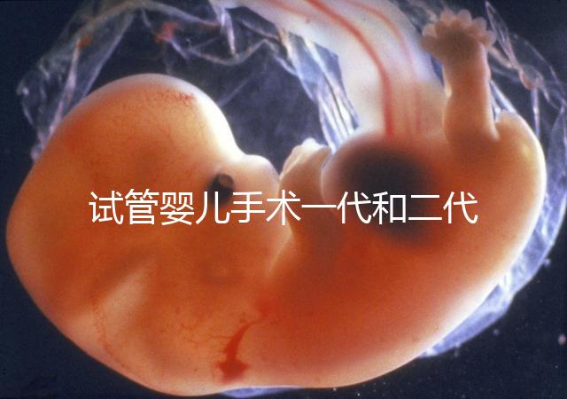 試管嬰兒手術一代和二代有哪些區(qū)別？