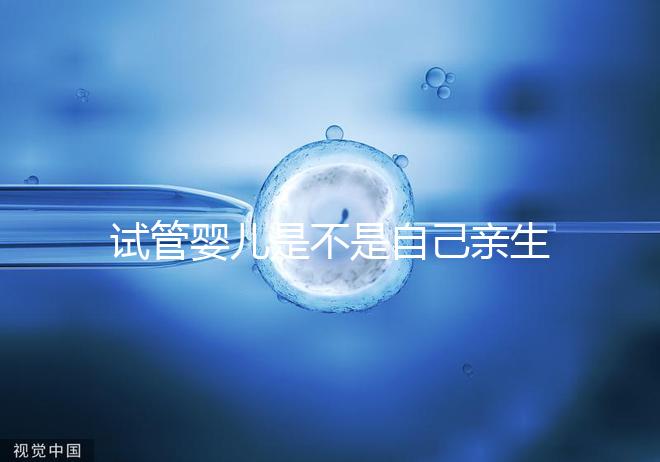 試管嬰兒是不是自己親生的（做試管嬰兒是不是自己的孩子）