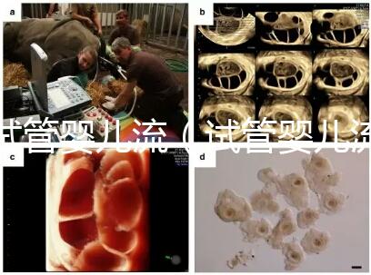 試管嬰兒流（試管嬰兒流程步驟與時間）