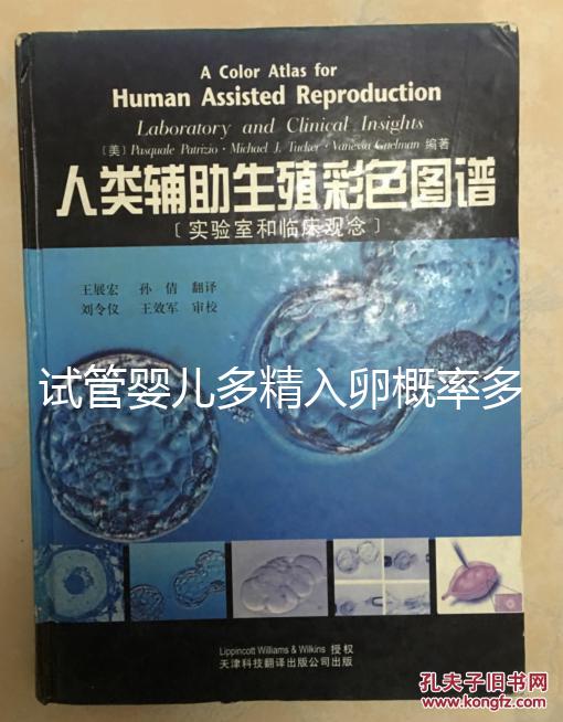 試管嬰兒多精入卵概率多少難說(shuō)，比正常配對(duì)低別瞎操心