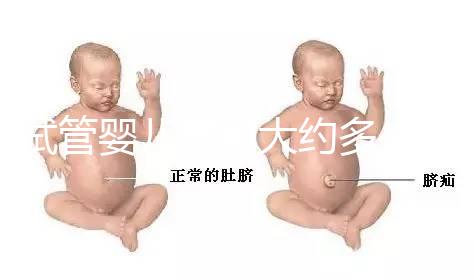 試管嬰兒費(fèi)用大約多少2021年(試管嬰兒費(fèi)用大約多少2021年鄭州)