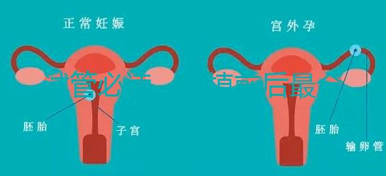 試管必讀，移植前后最全注意事項(xiàng)？