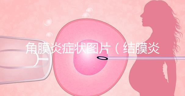 角膜炎癥狀圖片(結膜炎和角膜炎的區別)