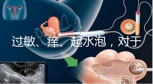 過敏、癢、起水泡，對于三伏貼的副作用你需知道該怎么辦
