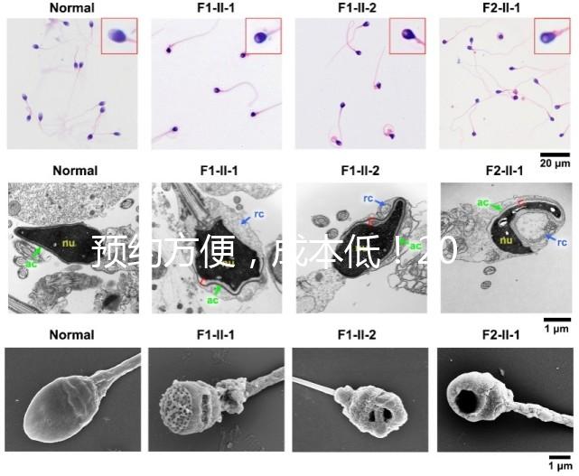 預約方便，成本低！2024年西安新城、臨潼、雁塔四維彩超指南