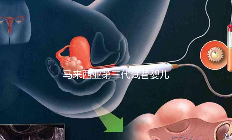 馬來西亞第三代試管嬰兒限時優(yōu)惠套餐12萬元人民幣