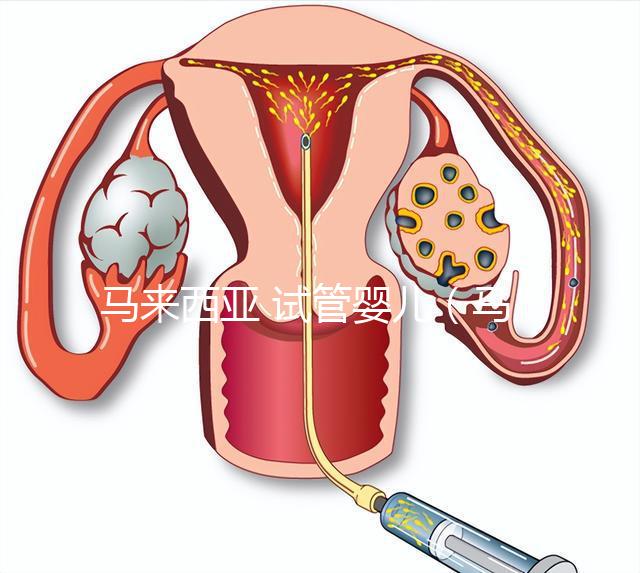 馬來西亞 試管嬰兒（馬來西亞試管嬰兒和泰國比較哪個更好）