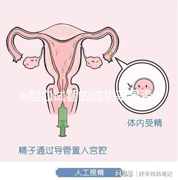 o型血試管的成功率是否高取決于這一點分享真正好的懷孕案例
