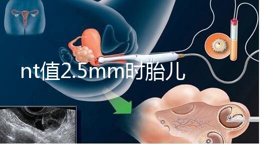 nt值2.5mm時(shí)胎兒異常幾率并不高，但羊水穿刺一定要做